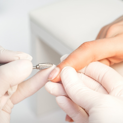 Le Démaillage Semi-permanent