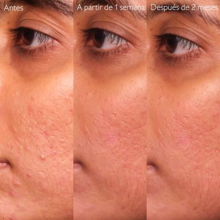 Sérum Anti-Imperfections Vinopure à l'Acide Salicylique