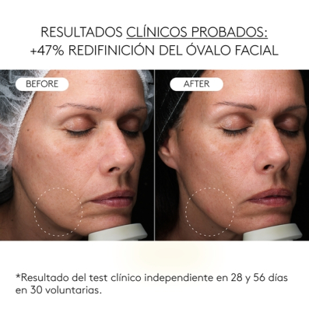 Clinical Exosomas SerÃºm