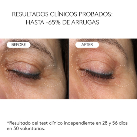 Clinical Exosomas SerÃºm