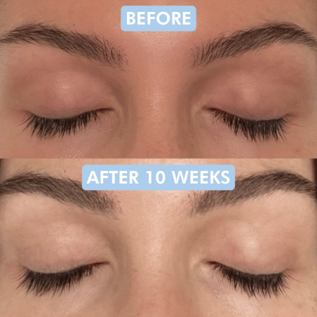 Better Brows Siero