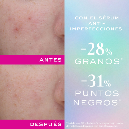 Zinc Power Sérum Anti-Imperfeições