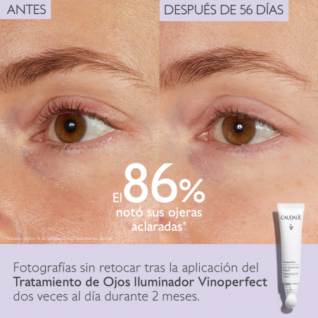 VINOPERFECT ILUMINADOR TRATAMENTO OCULAR