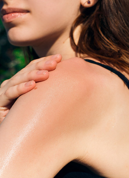 solar aftersun solar aftersun